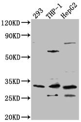 COMT Recombinant Monoclonal Antibody
