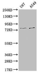 SLC25A12 Recombinant Monoclonal Antibody
