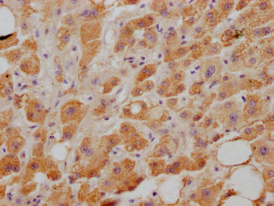 NPC1L1 Recombinant Monoclonal Antibody