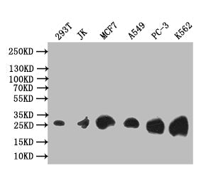 TK1 Recombinant Monoclonal Antibody