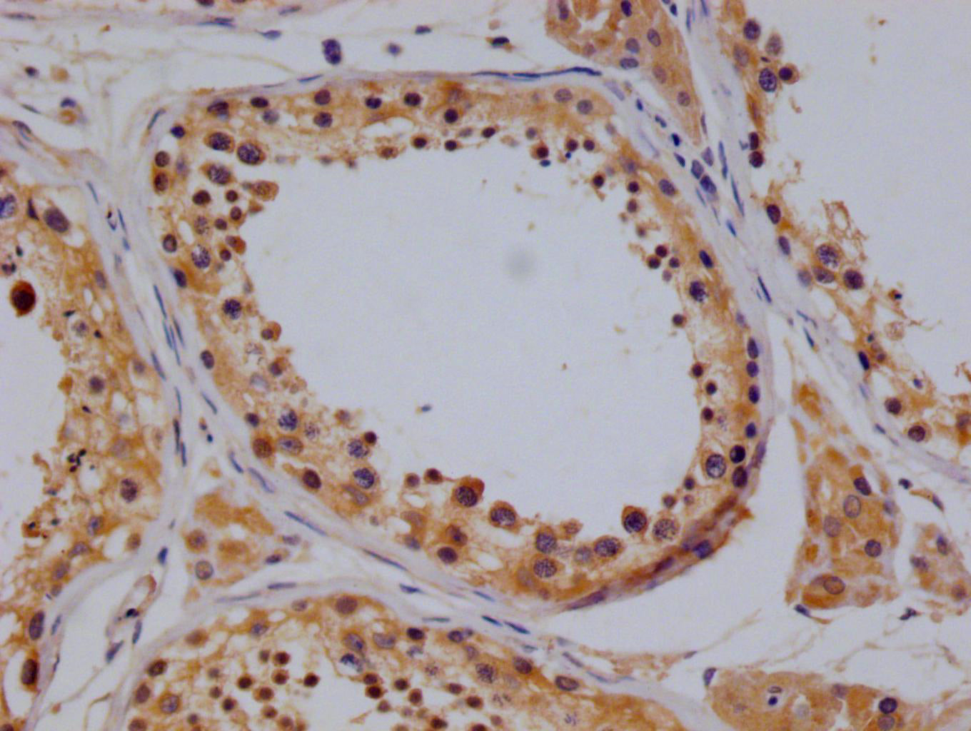 TBK1 Recombinant Monoclonal Antibody
