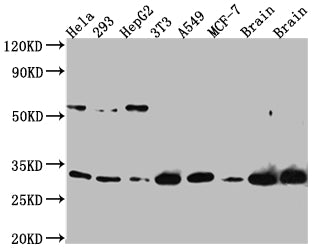 PGAM1 Recombinant Monoclonal Antibody