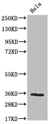 NUDT5 Recombinant Monoclonal Antibody