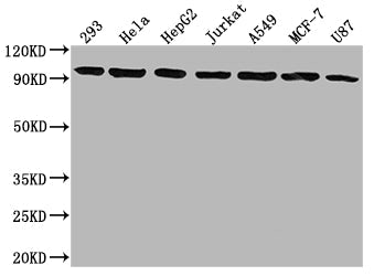 NR3C1 Recombinant Monoclonal Antibody