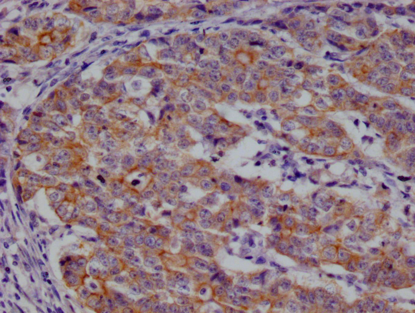 CSN2 Recombinant Monoclonal Antibody