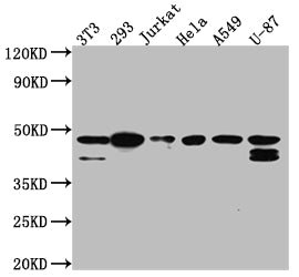 CSNK2A1 Recombinant Monoclonal Antibody