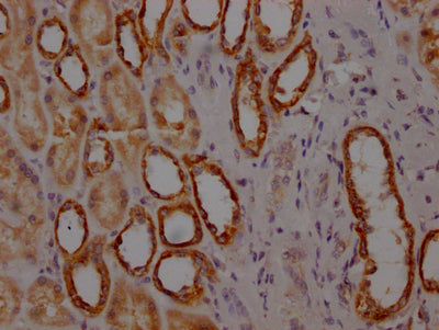 MYBBP1A Recombinant Monoclonal Antibody