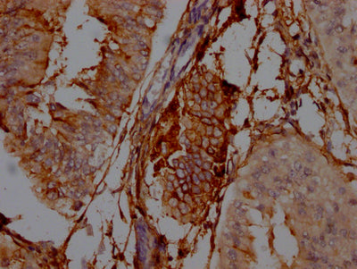 NT5E Recombinant Monoclonal Antibody