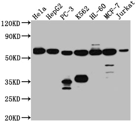 PTBP1 Recombinant Monoclonal Antibody