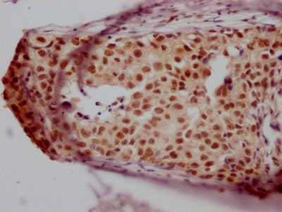 JUNB Recombinant Monoclonal Antibody