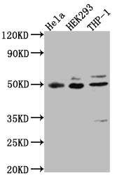 MAPKAPK2 Recombinant Monoclonal Antibody