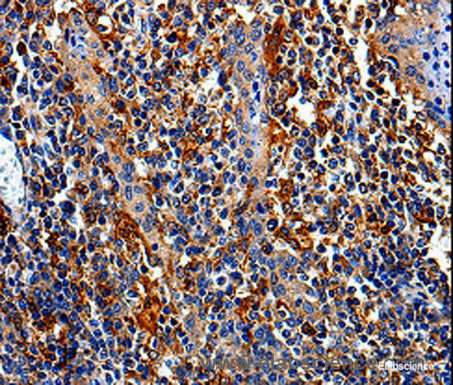 Immunohistochemistry of paraffin-embedded Human tonsil tissue using COX16 Polyclonal Antibody at dilution 1:50