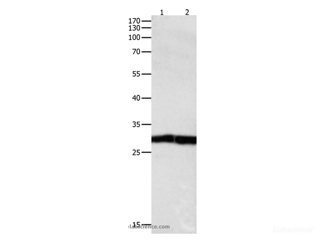 Western Blot analysis of Jurkat cell and Human fetal kidney tissue using MKP-3 Polyclonal Antibody at dilution of 1:450