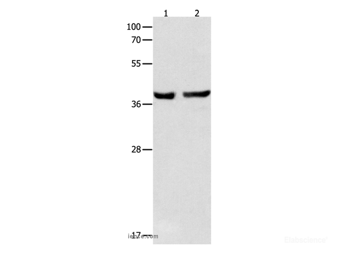 Western Blot analysis of Mouse esophagus and Human cervical cancer tissue using SERPINB5 Polyclonal Antibody at dilution of 1:1000