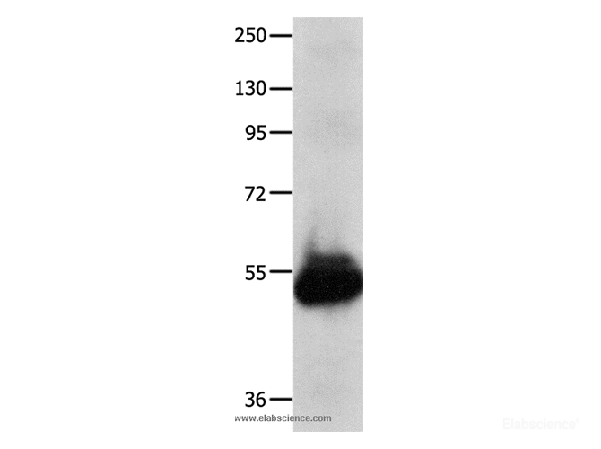 Western Blot analysis of Human kidney cancer tissue using KCNA1 Polyclonal Antibody at dilution of 1:600