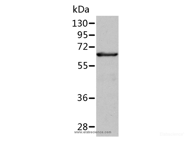 Western Blot analysis of Human fetal liver tissue using ALDH4A1 Polyclonal Antibody at dilution of 1:350