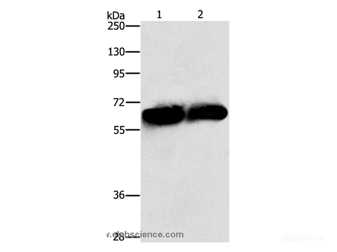 Western Blot analysis of Lovo and 231 cell using ASNS Polyclonal Antibody at dilution of 1:1000