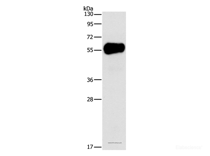 Western Blot analysis of Mouse pancreas tissue using AMY2A Polyclonal Antibody at dilution of 1:1550
