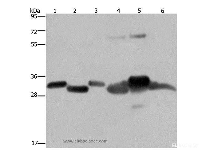 Western Blot analysis of Mouse thymus and Human ovarian cancer tissue, Mouse heart, Human fetal liver, Mouse liver tissue and SKOV3 cell using HMGCL Polyclonal Antibody at dilution of 1:300