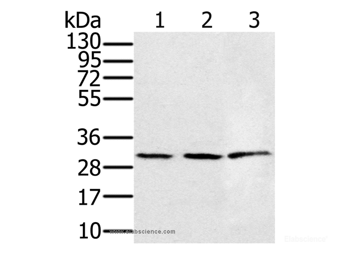 Western Blot analysis of 293T and K562 cell, Human fetal liver tissue using HSD17B8 Polyclonal Antibody at dilution of 1:450