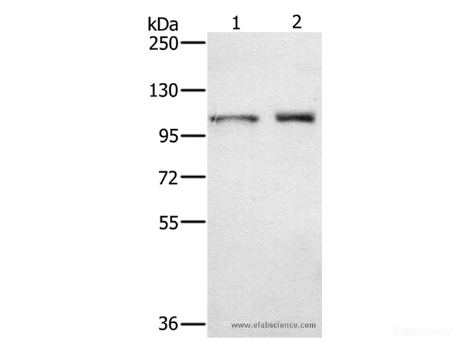 Western Blot analysis of Human testis tissue and K562 cell using ODF2 Polyclonal Antibody at dilution of 1:650