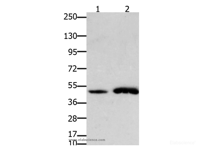 Western Blot analysis of Mouse brain and heart tissue using FOXL2 Polyclonal Antibody at dilution of 1:750