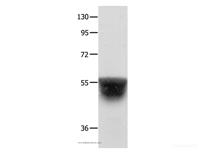 Western Blot analysis of Human brain malignant glioma tissue using KCNA1 Polyclonal Antibody at dilution of 1:400