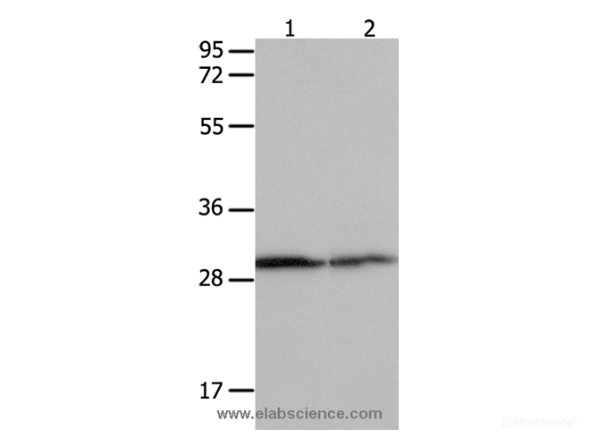 Western Blot analysis of Hela cell and Mouse kidney tissue using 14-3-3 beta/alpha Polyclonal Antibody at dilution of 1:550
