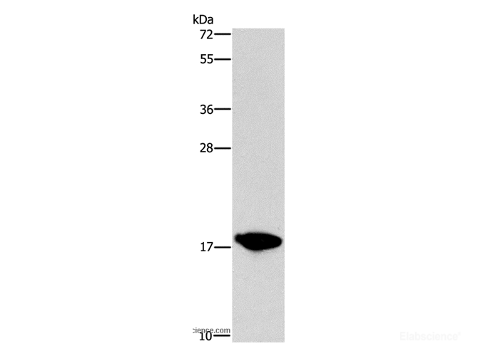 Western Blot analysis of HepG2 cell using CCL16 Polyclonal Antibody at dilution of 1:760