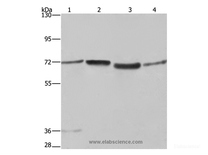 Western Blot analysis of A375 and 231 cell, 293T cell and Human hepatocellular carcinoma tissue using SYN1 Polyclonal Antibody at dilution of 1:550