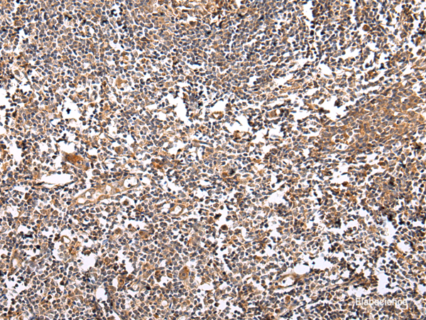 Immunohistochemistry of paraffin-embedded Human tonsil using VSIG8 Polyclonal Antibody at dilution of 1/30