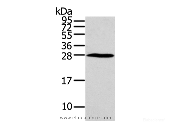 Western Blot analysis of Huvec cell using HOXC6 Polyclonal Antibody at dilution of 1/550