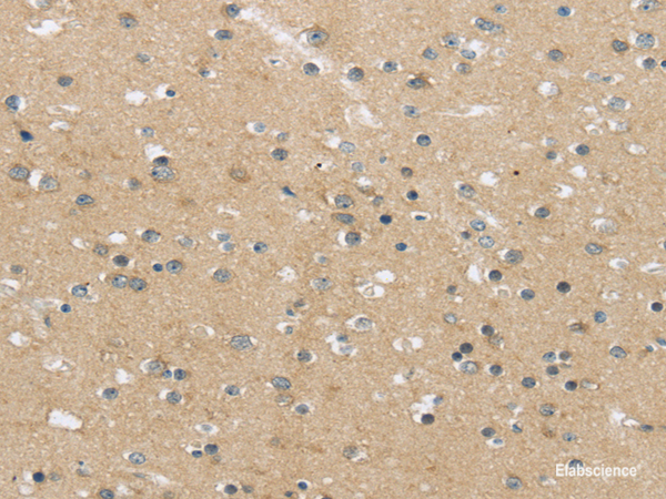 Immunohistochemistry of paraffin-embedded Human brain using MPP6 Polyclonal Antibody at dilution of 1/25
