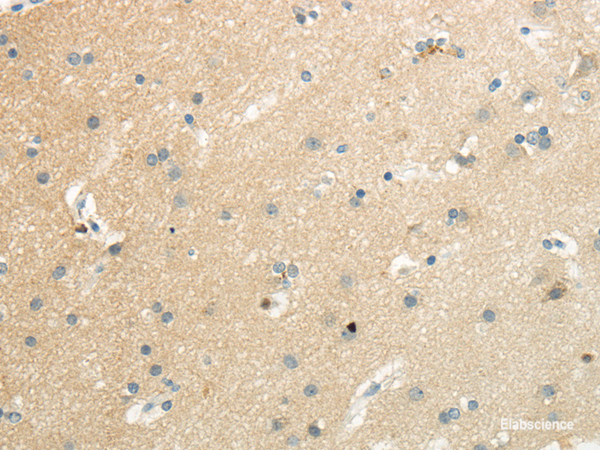 Immunohistochemistry of paraffin-embedded Human brain using SLC7A11 Polyclonal Antibody at dilution of 1/35