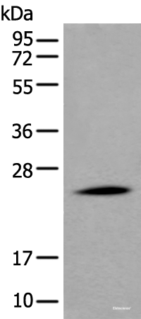Western blot analysis of Human liver tissue lysate using APOD Polyclonal Antibody at dilution of 1:550