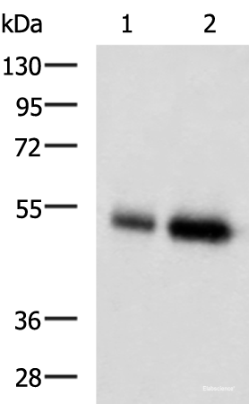 Western blot analysis of Human placenta tissue and Human right lower lung tissue lysates using BMP5 Polyclonal Antibody at dilution of 1:450