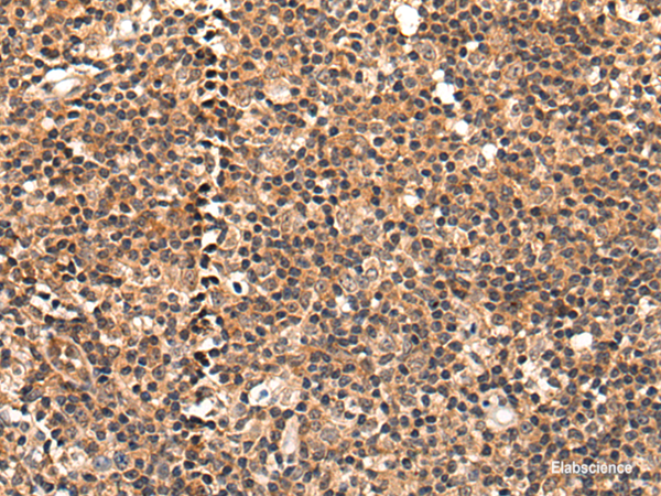 Immunohistochemistry of paraffin-embedded Human tonsil tissue using C16orf45 Polyclonal Antibody at dilution of 1:45(×200)