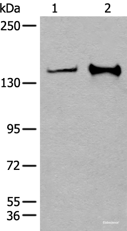 Western blot analysis of Hela and A172 cell lysates using CAPN15 Polyclonal Antibody at dilution of 1:400