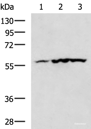 Western blot analysis of Mouse heart tissue Human heart tissue Rat heart tissue lysates using CAMK2G Polyclonal Antibody at dilution of 1:400