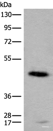 Western blot analysis of Human cerebella tissue lysate using CADM2 Polyclonal Antibody at dilution of 1:2000