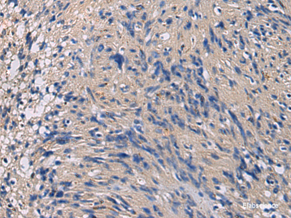Immunohistochemistry of paraffin-embedded Human brain tissue using CHST3 Polyclonal Antibody at dilution of 1:35(×200)