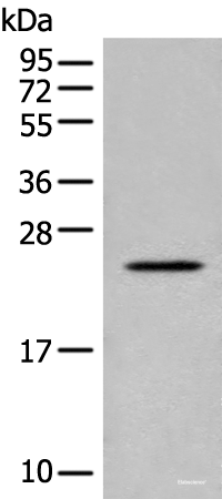 Western blot analysis of Human placenta tissue lysate using CARD16 Polyclonal Antibody at dilution of 1:800