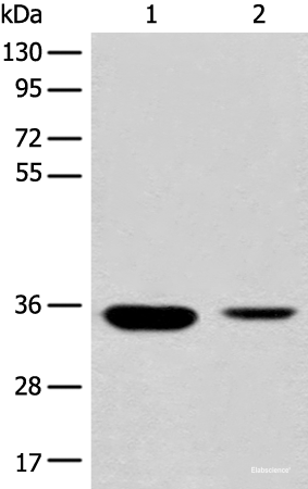 Western blot analysis of Mouse liver tissue and Human fetal liver tissue lysates using RGN Polyclonal Antibody at dilution of 1:500
