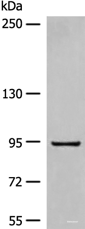 Western blot analysis of Human fetal liver tissue lysate using DMGDH Polyclonal Antibody at dilution of 1:800