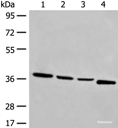 Western blot analysis of Human breast cancer tissue TM4 231 and Jurkat cell lysates using OTUD6A Polyclonal Antibody at dilution of 1:550