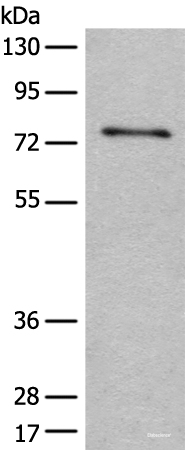 Western blot analysis of Human hepatocellular carcinoma 2 tissue lysate using ADGRE3 Polyclonal Antibody at dilution of 1:400