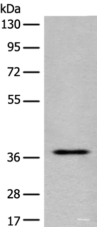 Western blot analysis of Jurkat cell lysate using EN2 Polyclonal Antibody at dilution of 1:400