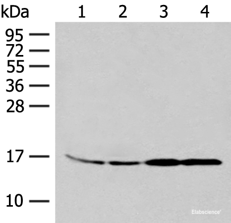 Western blot analysis of 293T and K562 cell Human between peritoneal stromal sarcoma tissue HEPG2 cell lysates using MYDGF Polyclonal Antibody at dilution of 1:250