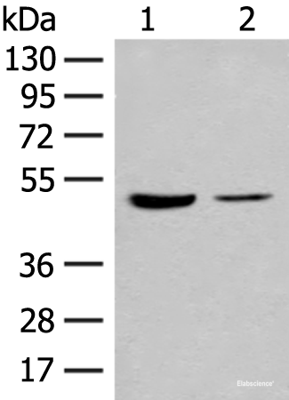 Western blot analysis of Human fetal brain tissue and Jurkat cell lysates using IL7R Polyclonal Antibody at dilution of 1:500