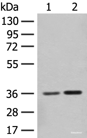 Western blot analysis of Mouse brain tissue and Rat brain tissue lysates using SLC25A27 Polyclonal Antibody at dilution of 1:350